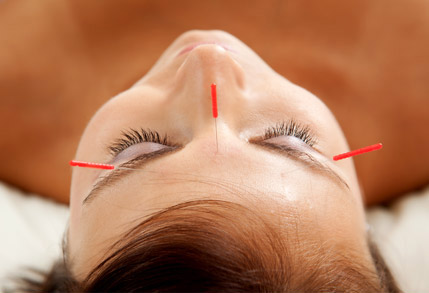 Cosmetic Acupuncture