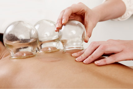 Cupping Therapy