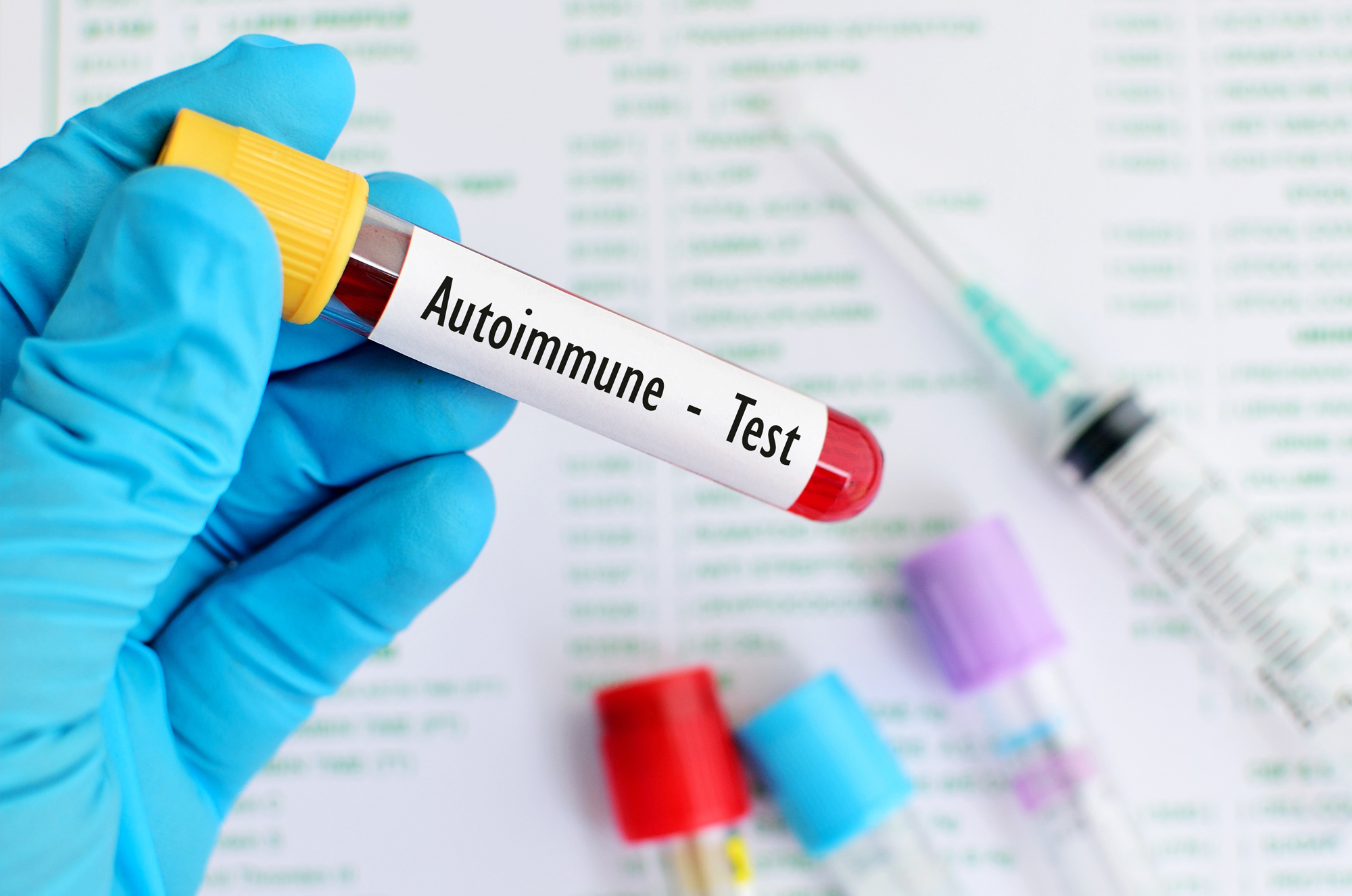 Dietary intervention & Autoimmune diseases