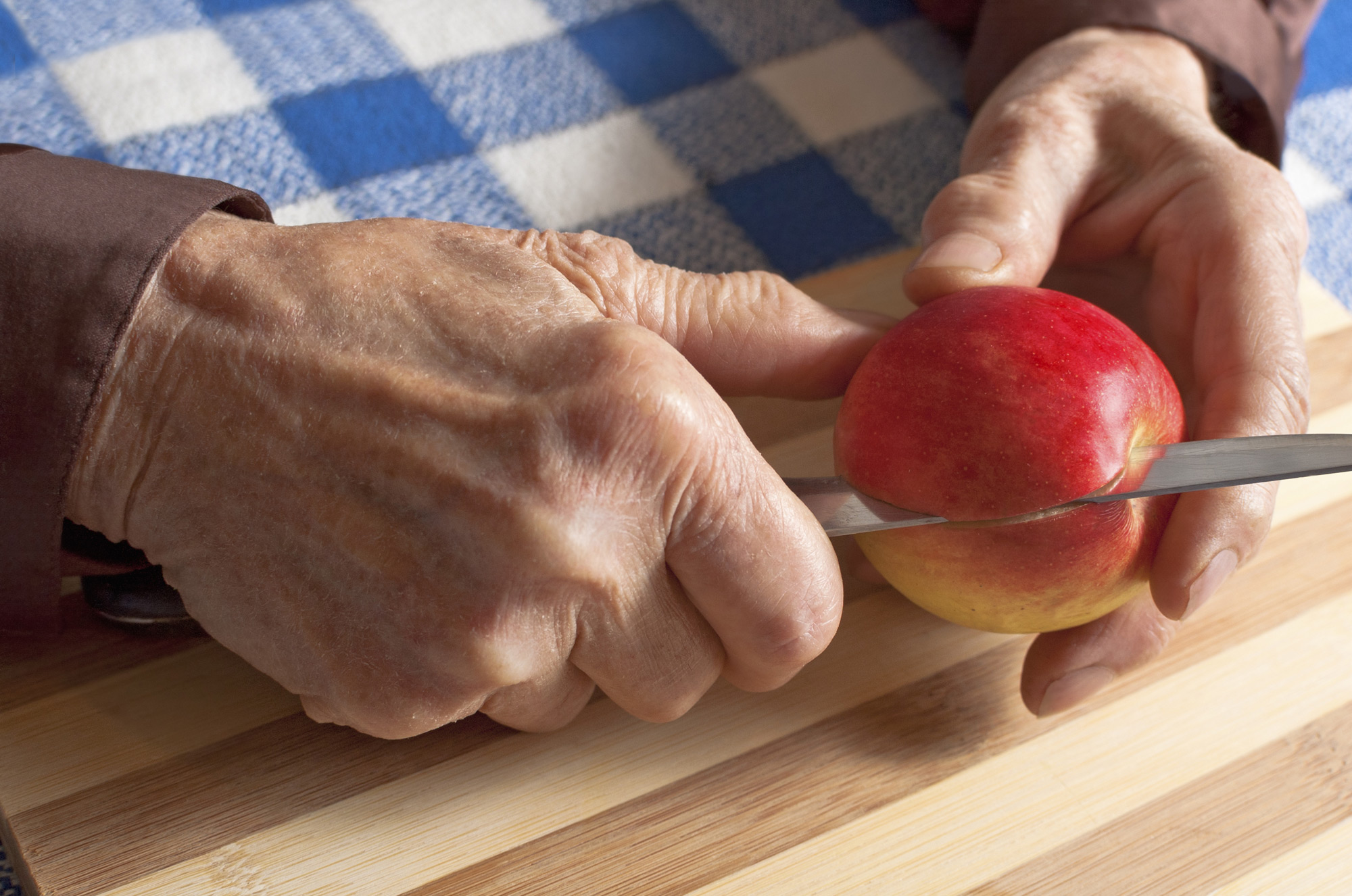 Nutrition & Rheumatoid Arthritis