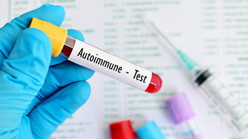 Dietary intervention & Autoimmune diseases