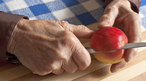 Nutrition & Rheumatoid Arthritis