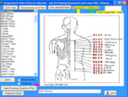 Quantum Biofeedback & Bioresonce, the Energetic Medicine of the future!